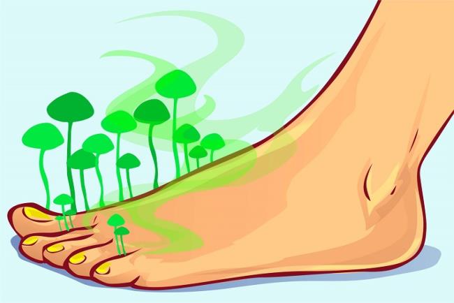 אילוסטרציה של כף רגל שצומחות ממנה פטריות, קלוטרימאזול, אגיסטן